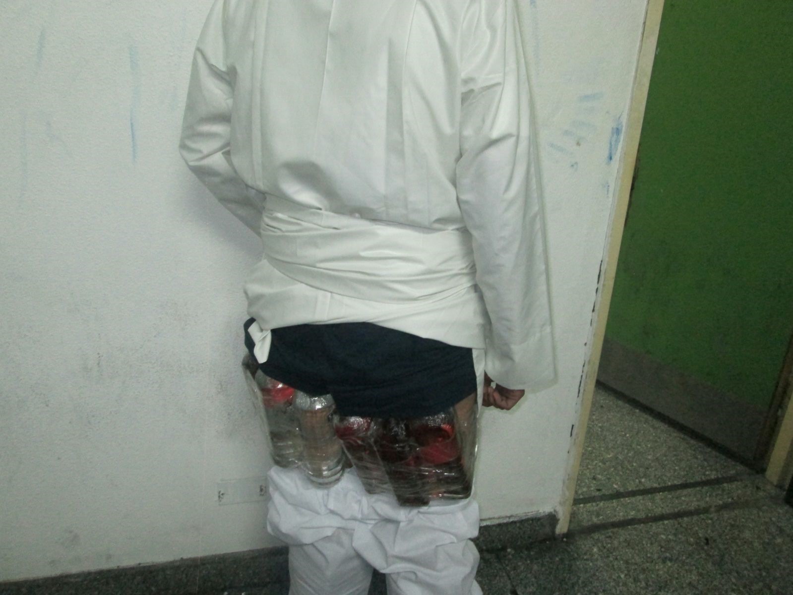 شاهد بالصور أغرب عملية تهريب لـ 14 زجاجة خمر في جسد ومؤخرة مواطن سعودي