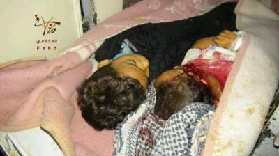 مقتل 3 اطفال وجرح آخرين في قصف حوثي على حي سكني في مدينة تعز ( صوره - الأسماء)