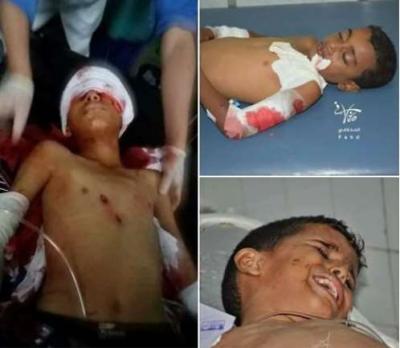 حقوق الانسان تقول بأن مجزرة الحوثيين بحق الاطفال في تعز جريمة حرب ضد الإنسانية