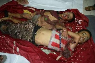 استشهاد واصابة 8 اطفال بتعز في مجزرة جديدة للحوثيين ( الأسماء)