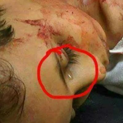 شاهد صورة الطفل اليمني التي تدمي القلب وتبكي العين عقب مقتله والدموع تنزل من عينيه 