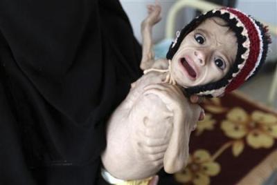 الصليب الأحمر: ملايين اليمنيين ينامون جوعى كل ليلة 