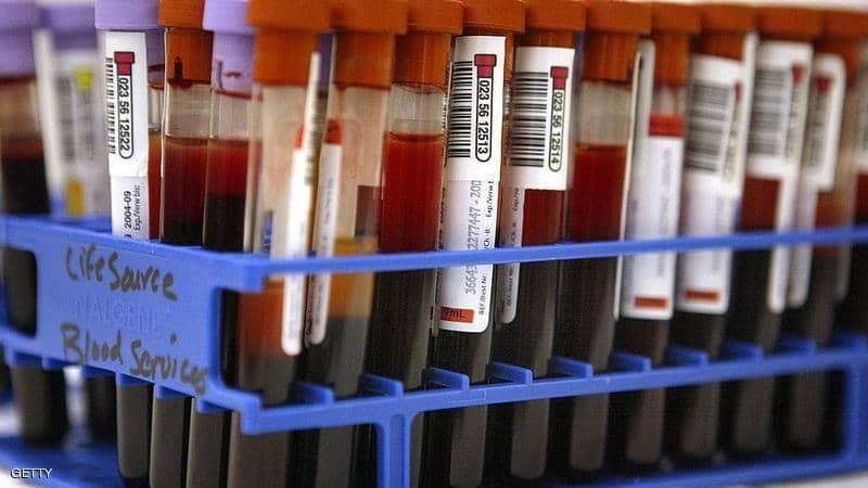 دراسة تحدد العلاقة بين فصيلة الدم و"أعراض كورونا"