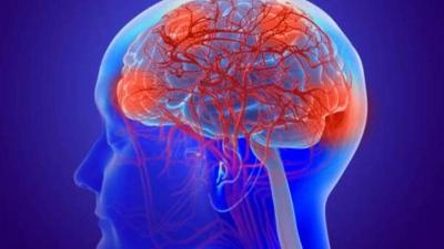 علماء يتوصلون لعلاج مناعي لسرطان الدماغ