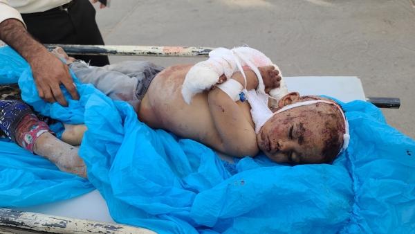 قتلى وجرحى من الأطفال والنساء جراء إستهداف الحوثيين لمأرب بصواريخ باليستية