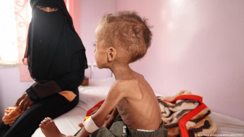 اليونيسف تحذر من انزلاق ملايين اليمنيين إلى المجاعة تأثراً بانهيار الاقتصاد