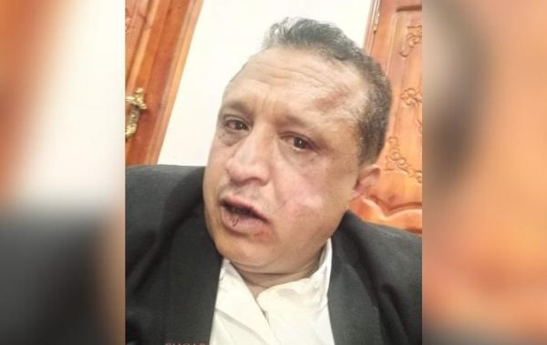 إدانات واسعة ضد الإعتداء الحوثي على الصحفي "مجلي الصمدي" في صنعاء