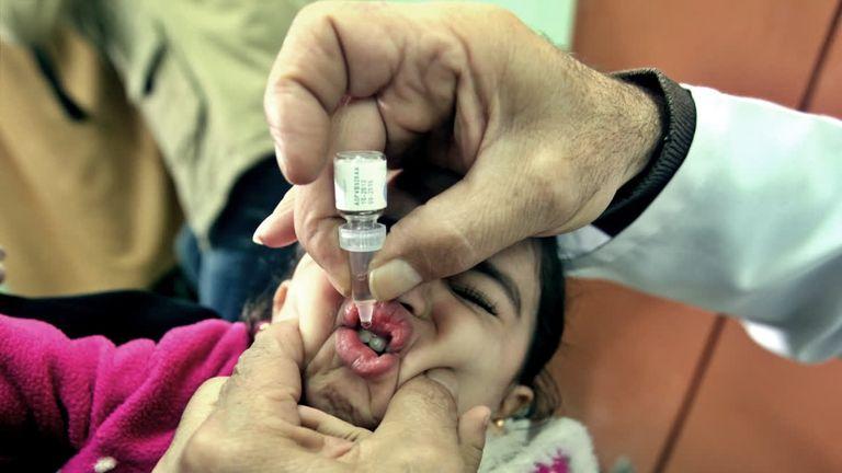 تقرير للصحة العالمية: تسجيل 237 حالة إصابة بفيروس شلل الأطفال في اليمن